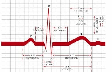 ecg